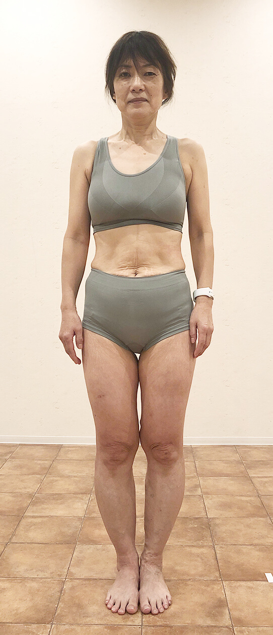 NORIKOさん 1カ月後